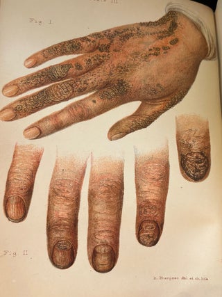 Diseases of the Skin an Outline of the Principles and Practice of Dermatology